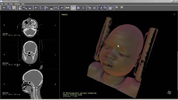 4) Using Ambivu in view-mode: volume rendering part 1