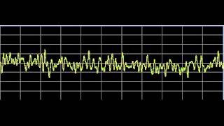Metabolism Repair - Rife Frequencies
