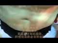 GoldenShape Serum 打造黄金比例击退腰部赘肉