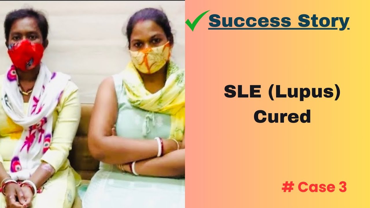 Case 3 Bengali Yes SLE (Lupus) is also curable miracle of
