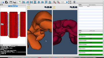 Medic-Blocks (v0.4.99.60) - Statistical Shape Model