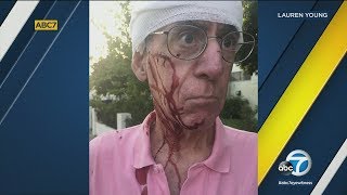 Elderly man shares his story of vicious, random attack in Los Feliz | ABC7