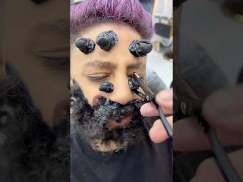 ازالة الحباية المتسلطنة من الخد