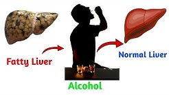 FATTY LIVER TREATMENT IN 7 DAYS