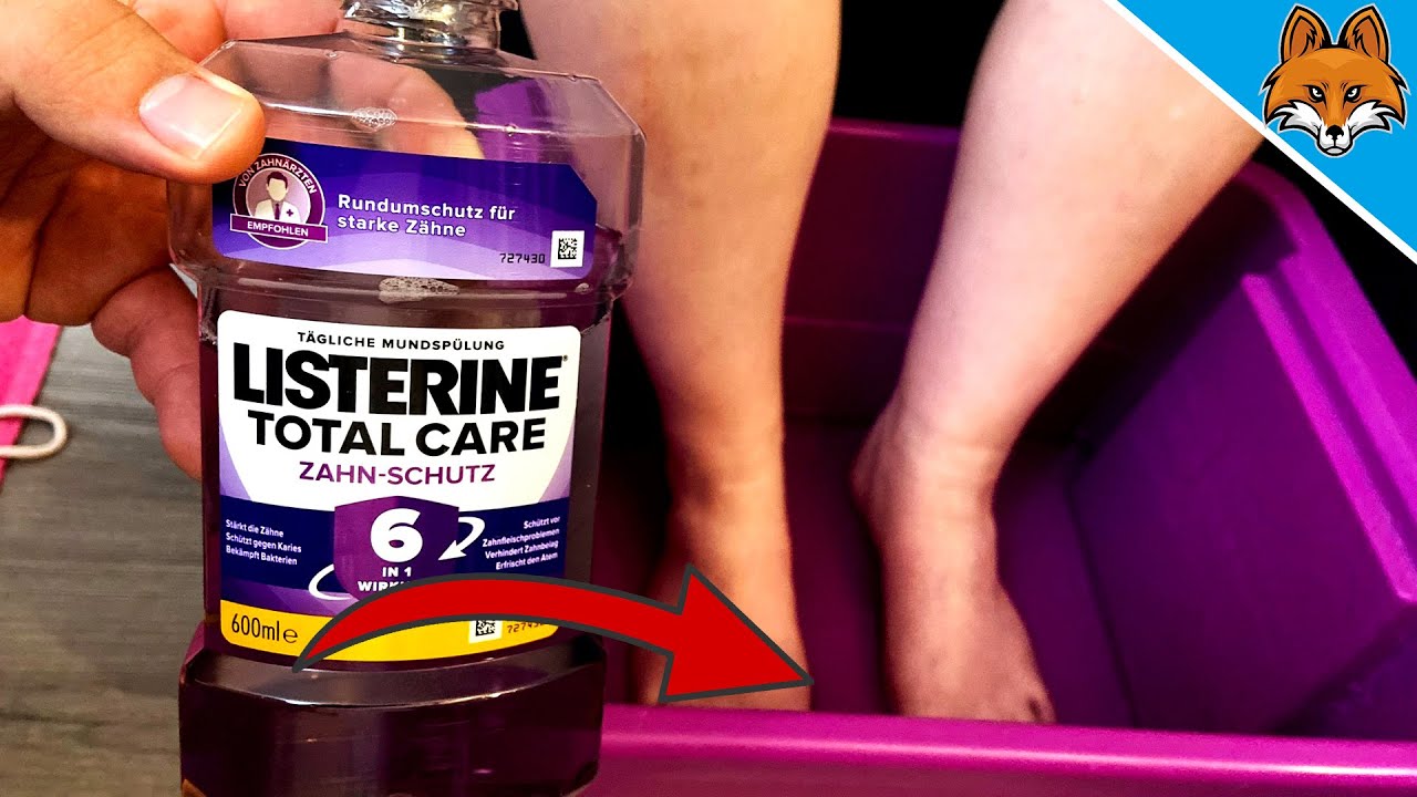 BATH your FEET in MOUTHWASH and BE AMAZED about the Result 💥 YouTube