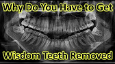 Dentist Rancho Cucamonga, CA 909 987 7676 *Rancho Cucamonga Dentist - YouTube