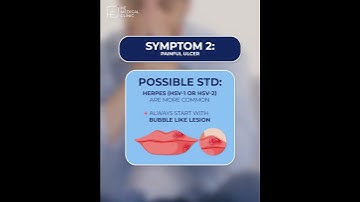 How do I know if I have STD?