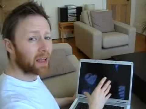 Limmy: "David Robertson's Pen Trick" (2007)