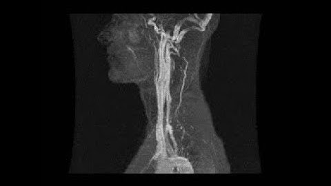 إبراهيم فايض - سورة ق