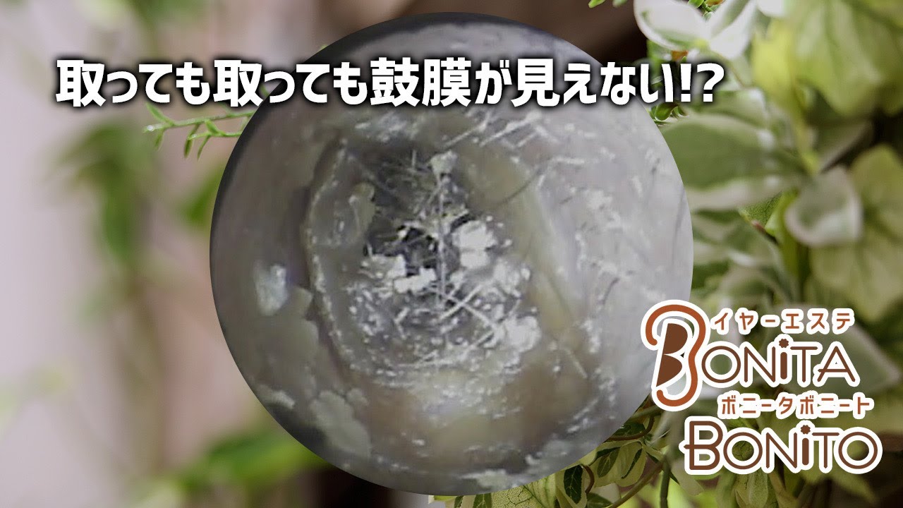 耳掃除 取っても取っても鼓膜が見えない Youtube