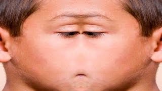 Как убрать прыщи с фотографии в Photoshop CS5 Как убрать прыщи с фотографии в Photoshop CS5