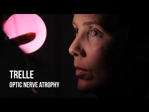 Video: Partial Optic Nerve Atrophy