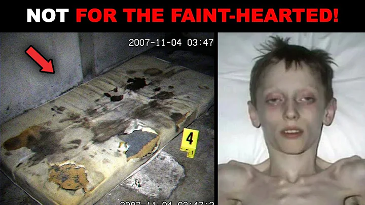 "CHILD weighed 10 kg at 7! Doctors paralyzed when they found out WHAT the parents did..."