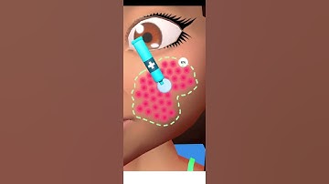 Parasite Cleaner part 4 (Days 3 Gameplay Walkthrough Mobile Gameplay) Android, iOS