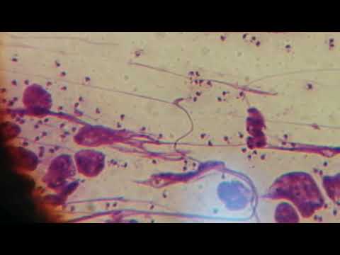 Video: Leishmania-koiran Infektio, Jolla On Ihoa