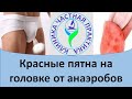 Красные пятна на головке при анаэробах