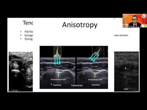 Video: Apakah air mata labral glenoid bisa sembuh?