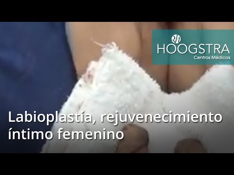 ultrasonido portatil Labioplastía, rejuvenecimiento íntimo femenino (18121)