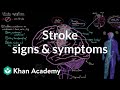 Common stroke signs and symptoms | Circulatory System and Disease | NCLEX-RN | Khan Academy