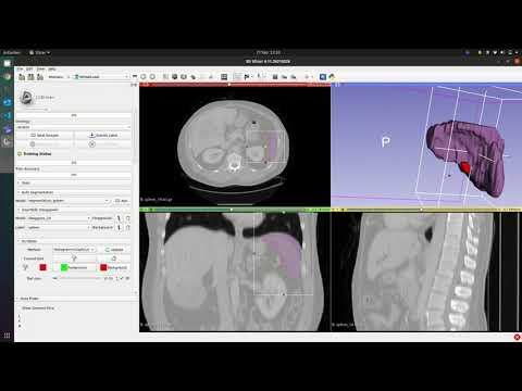 MONAILabel v0.2 ROI Scribbles for Interactive Segmentation