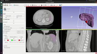 MONAILabel v0.2 ROI Scribbles for Interactive Segmentation