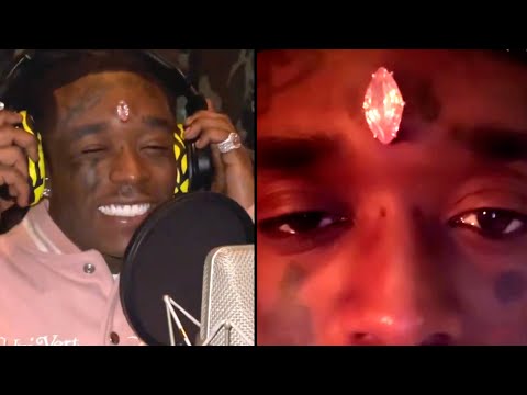 Lil Uzi Vert Dropped 24 Million On A Diamond Face Implant