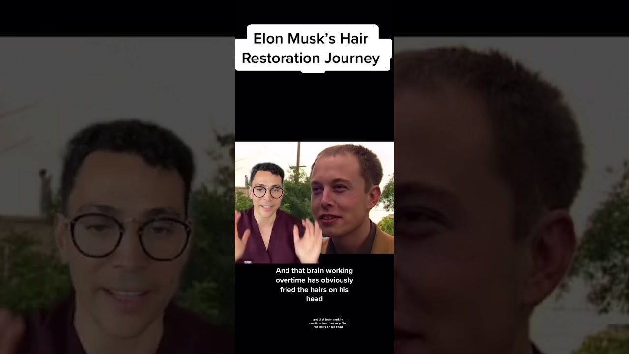 Elon Musk hair transplant journey pt.1