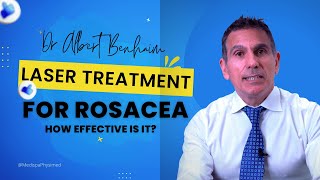 Laser Treatment For Rosacea: How Effective Is It?