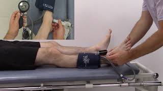 How to measure Ankle-Brachial Pressure Index (ABPI)