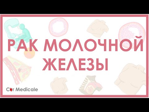 Видео: Вызывают ли корневые каналы рак молочной железы?