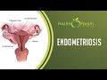 21 January 2020 | Word of the Day: Endometriosis