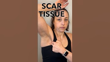 Massage HIER na verwijdering lymfeklieren #borstkanker