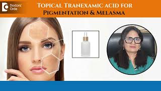 How to get rid of Pigmentation | Tranexamic acid for Melasma - Dr. Aruna Prasad | Doctors