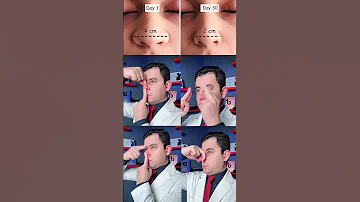 تمارين تحسين شكل الانف 