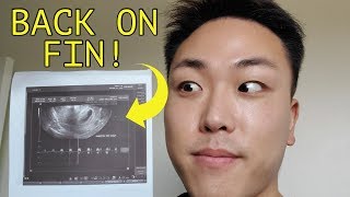 Im Finally Back On Finasteride Again