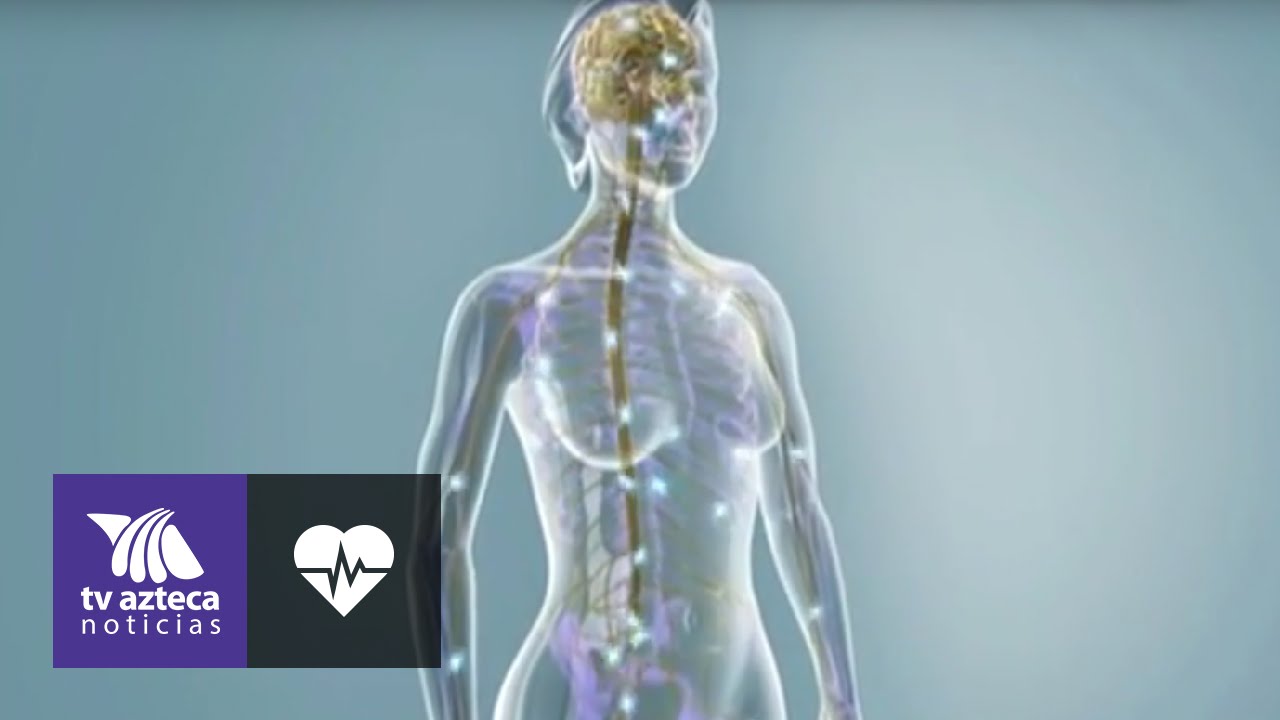 ¿Cómo afecta la esclerosis múltiple al cerebro?