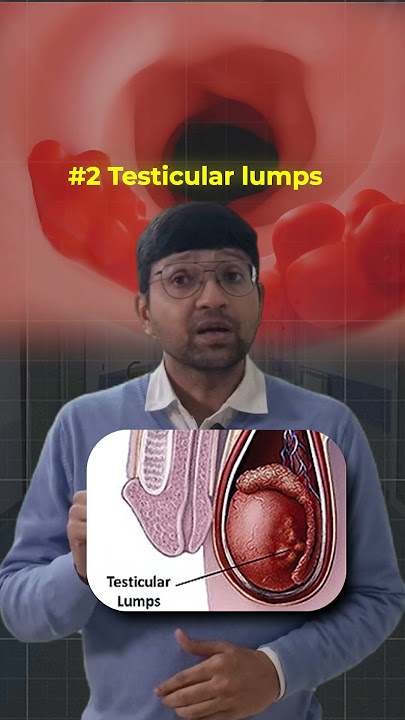 Andkosh Me Dard Aur Sujan Hone Ka Lakshan | Symptoms of Testicular Pain #maleinfertility #menshealth