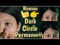 Really helps to remove dark circles | puffiness | wringles | Under eye bags | 100% Naturally | Tamil