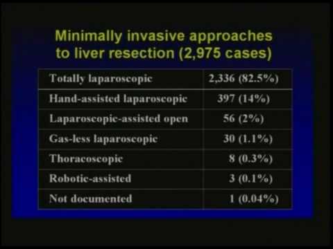 Laparoscopic Hepatic Resection,David Geller,MD. .....