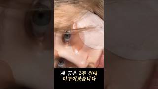 2주 만에 꿈을 이룬 가슴성형+얼굴지방이식 후기