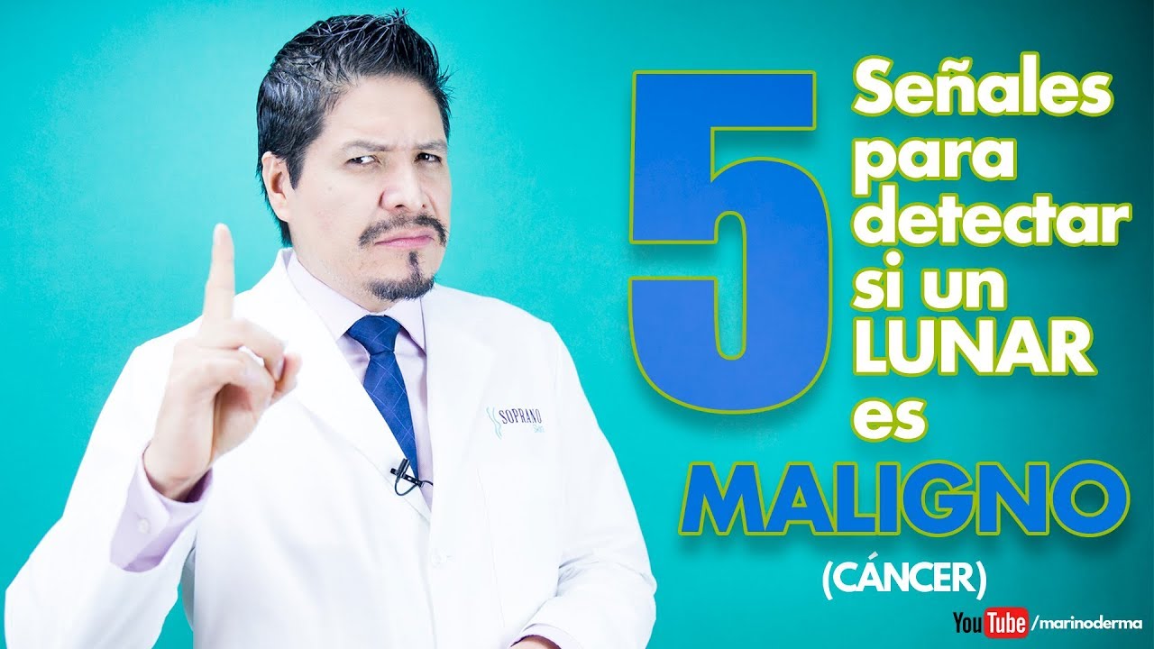 5 señales para detectar un lunar maligno (cancer de piel melanoma) II Dr Marino Dermatólogo