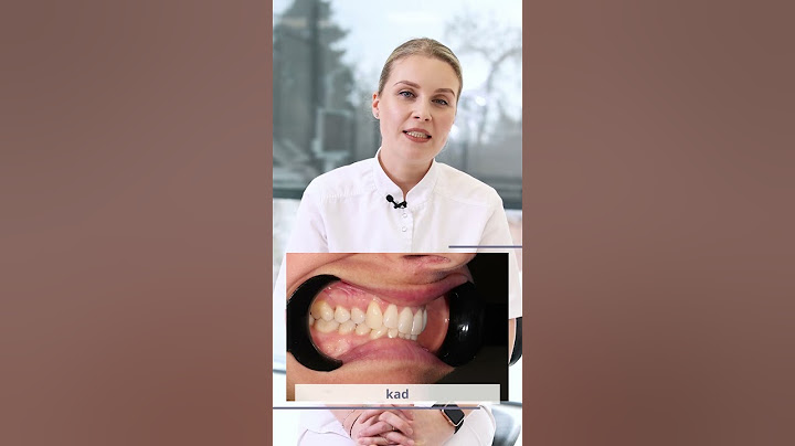 Ortodontinis gydymas breketų sistemomis