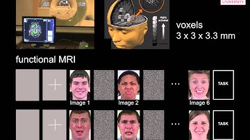 A Neural Basis of Facial Action Recognition