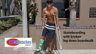 Skateboarding with Broken Leg Down Boardwalk