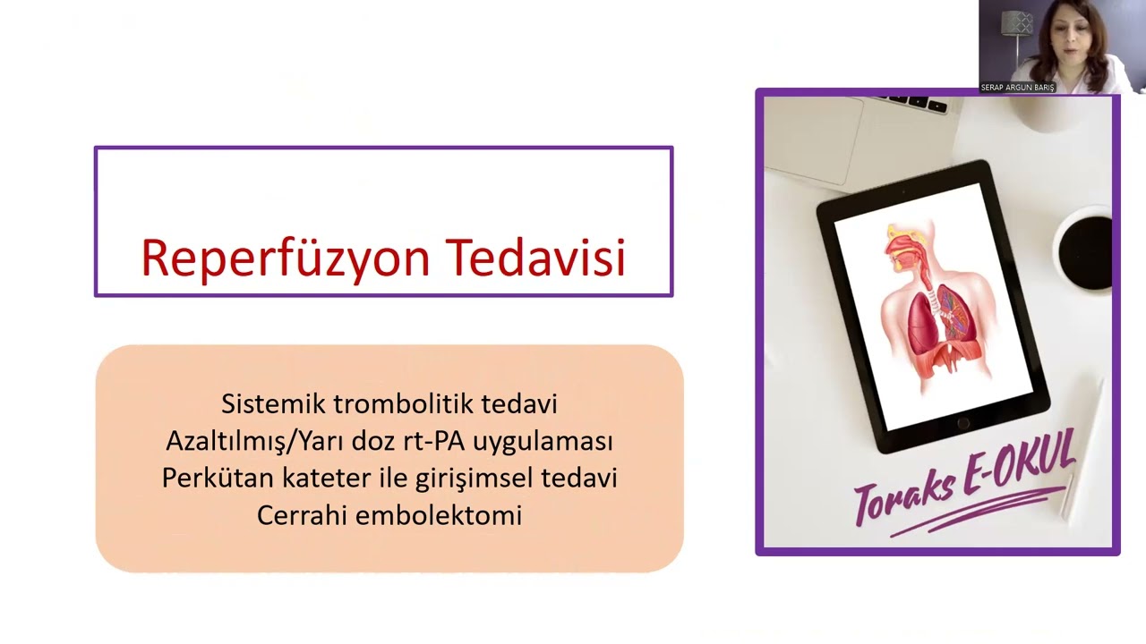 Pulmoner tromboemboli tedavisi 1 (Sağlık Profesyonelleri İçindir)