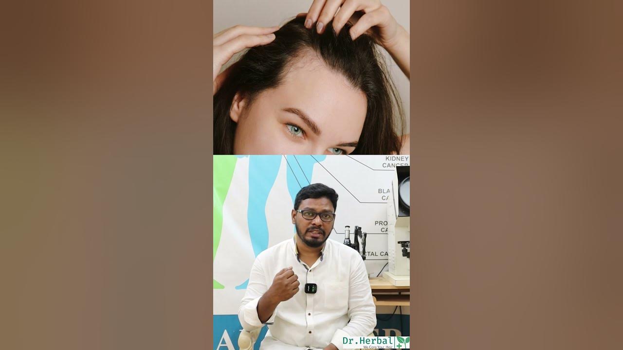 treatment-for-alopecia-areata