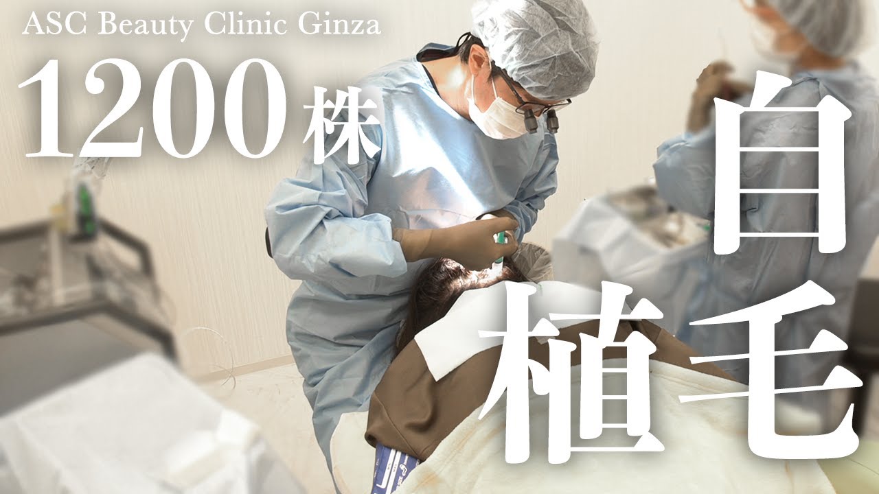 女性の植毛】1200グラフト自毛植毛施術〜施術編〜 - YouTube
