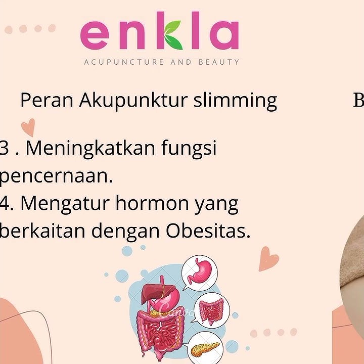 Akupunktur Slimming
