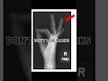 Don’t Lose Marks – Lateral Hand X-ray: Why Fingers Spread Out Is Better