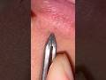 Plucking beard under the mouth #beardcare #asmrskincare #skincare #plucking #satisfying #asmrbeard